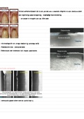 Samenvatting Cariologie DEEL 2