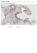 Histologie & Histopathologie: Ademhalingsstelsel De Long 