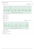 Advanced Dysrhythmia Exam 2025 Prep Questions