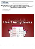 Relias  Advanced and Basic Exam A and B Dysrhythmia Clinical Assessment EKG Interpretation and Heart Arrhythmias Comprehensive Exam Study Guide 