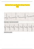 Relias Advanced Dysrhythmia Clinical Assessment  MonitorTech.org Rhythm Strips Practice Test