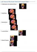 Lab Parts of The Skull Part 2 with images 2024