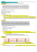 NUR 299 MEDSURG FINAL (GRADED A) EXAM | 100 OUT OF 100 - Molloy College