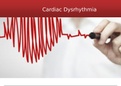 NURS 4014Cardiac Dysrhythmia.pptx