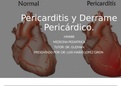 PERICARDITIS Y DERRAME PERICARDICO