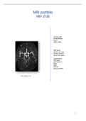 MRI MB1 portfolio