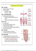 Five-Step Approach for EKG Interpretation Complete Cardiac Arrythmias Guide.