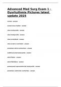 Advanced Med Surg Exam 1 - Dysrhythmia Pictures latest update 2025