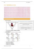 18/20 - Samenvatting ECG prof. Willems (vak bloedsomloop S1M1 GNK KUL)