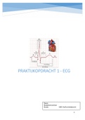 Praktijk II - Praktijkopdracht 1 ecg