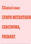 Clinical case: LYMPH METASTASIS CARCINOMA, PRIMARY MALIGNANT LYMPHONDA