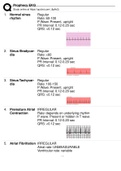 Foundations of EKG Interpretation - Prophecy Health Complete/ Prophecy EKG Terms And Explanations.