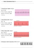 Relias Dysrhythmia Basic A Test 55 Questions and Answers 2024 (Basic A Dysrhythmia)  ||A+ GRADED