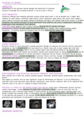 PATHOLOGY OF PANCREAS - Ultrasound 