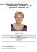 Case UNFOLDING Reasoning Case Study: Heart Failure, JoAnn Smith, 72 years old, (Latest 2021) 100% Correct Study Guide, Download to Score A  RAPID Reasoning Case Study: STUDENT Heart Failure History of Present Problem: JoAnn Smith is a 72-year-old woman wh