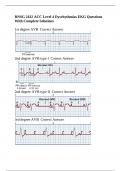 RNSG 2432 ACC Level 4 Dysrhythmias EKG Questions With Complete Solutions