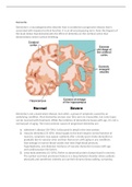 NR 507 Week 7 Assignment; CNS; Sensory and Motor Disorders (E-dapt Content)