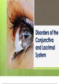 Disorders of the Conjunctiva and Lacrimal System