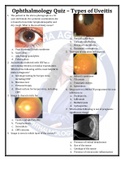 Ophtha Quiz_Types of Uveitis