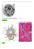 Summary slide test