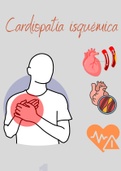 Cardiopatía Isquémica