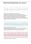 Relias Dysrhythmia Basic Test Answers 2022/23.