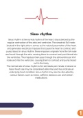 Sinus rhythm nclex rn notes 2023