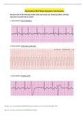 Dysrhythmia EKG Strips Questions And Answer