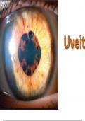 Uveitis and Systemic Diseases of the Eye: A Comprehensive Overview