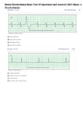 Relias Dysrhythmia Basic Test 35 Questions and Answers 2023 (Basic A Dysrhythmia)