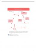 NUR 3125 Antiarrhythmic Agents Template 