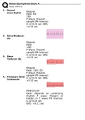 Relias Dysrhythmia Basic Test Answers Solution guide 2023