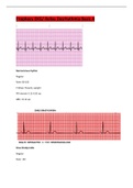 Relias Dysrhythmia Basic Test Answers Solution guide 2022-2023 (UPDATED 2023) A+ GRADED 100% VERIFIED