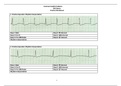 EKG Basics Practice Worksheet