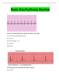 Relias Dysrhythmia Basic Review Answers 2023 Dysrhythmia – Basic A ( A+ GRADED 100% VERIFIED)