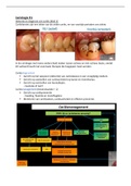 Samenvatting Cariologie kennisclips Mondzorgkunde Hoofdfase 1 HAN