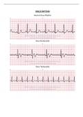  Relias Dysrhythmia Basic Test Answers Solution guides 2023 (100% Verified, Newly Updated)ALL BUNDLED TOGETHER!!! All you need to pass Relias Dysrhythmia Basic Tests!