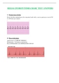 Relias Dysrhythmia Basic Test Answers Solution Guide |Latest 2023 / 2024 |