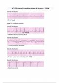 ACLS Pretest Exam Questions & Answers 2024