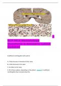  ASCP MLS Hematology Questions & Answers; Latest Updated   Insufficient centrifugation will result in:  A. A false increase in hematocrit (Hct) value B. A false decrease in Hct value C. No effect on Hct value D. All of these options, depending on the pati