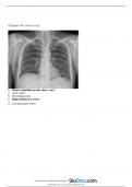 Chapter 45 chest x-ray