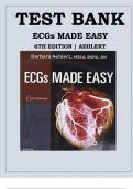 TEST BANK FOR ECGs Made Easy 6th Edition by Barbara J Aehlert , ISBN: 9780323401302 All Chapters Verified|| Guide A+