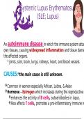 "Systemic Lupus Erythematosus (SLE): Pathophysiology, Diagnosis, Treatment, and Nursing Care"