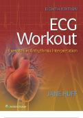 Complete Solution Manual for ECG Workout: Exercises in Arrhythmia Interpretation Eighth Edition, PDF File.