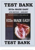 Test Bank for ECGs Made Easy 6th Edition by Barbara J Aehlert  Chapters 1-10 Complete Guide.