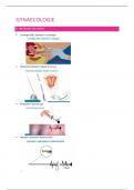 16/20 - Samenvatting Gynaecologie (vak Verloskunde-gynaecologie S2M1 GNK KUL)